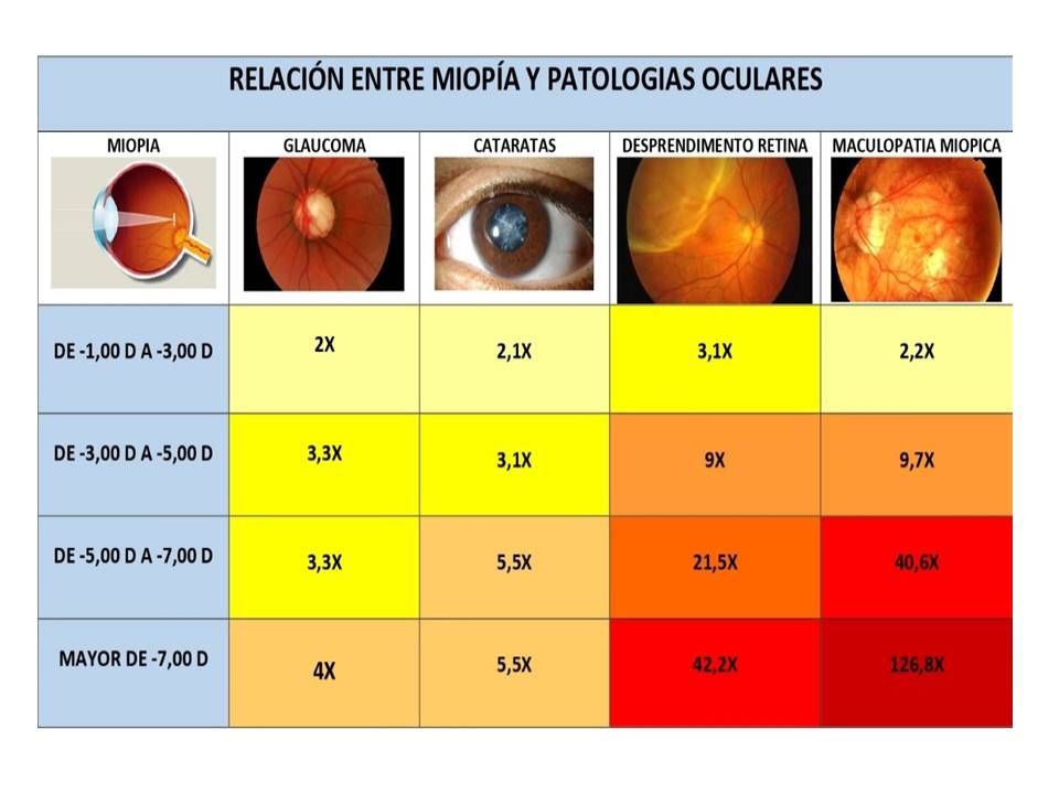Relación miopía y patologías oculares